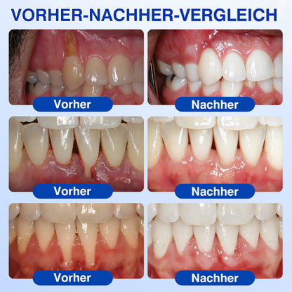 🇩🇪🏅🦷🛡️𝐋𝐮𝐱𝐚𝐫𝐢𝐬𝐞® GumRevive Parodontal-Reparaturgel
