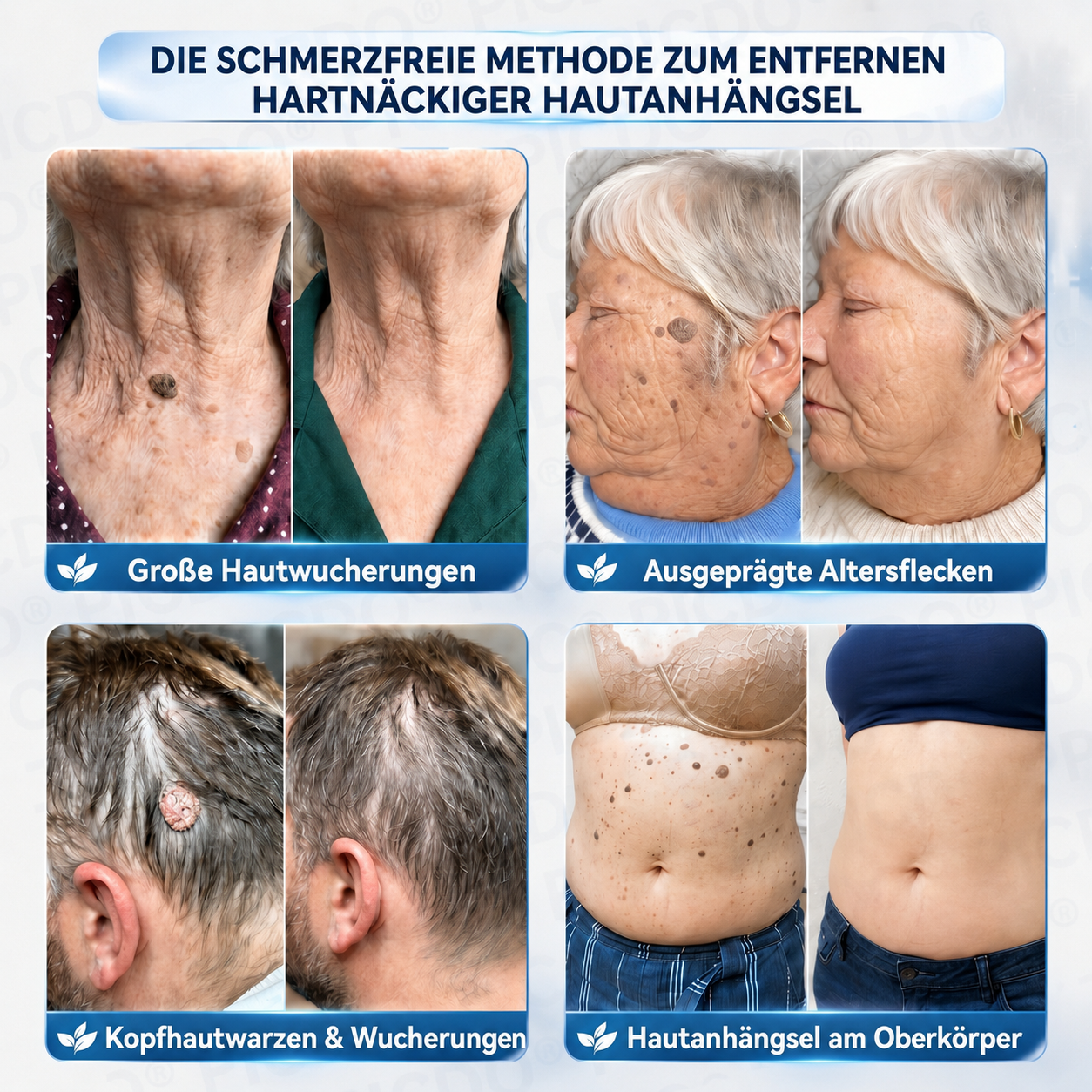 𝐏𝐢𝐜𝐝𝐨® 𝟕-𝐓𝐚𝐠𝐞 𝐈𝐧𝐭𝐞𝐧𝐬𝐢𝐯𝐩𝐟𝐥𝐞𝐠𝐞 𝐟𝐮̈𝐫 𝐇𝐚𝐮𝐭𝐚𝐧𝐡𝐚̈𝐧𝐠𝐬𝐞𝐥 & 𝐇𝐚𝐮𝐭𝐟𝐥𝐞𝐜𝐤𝐞𝐧🌿