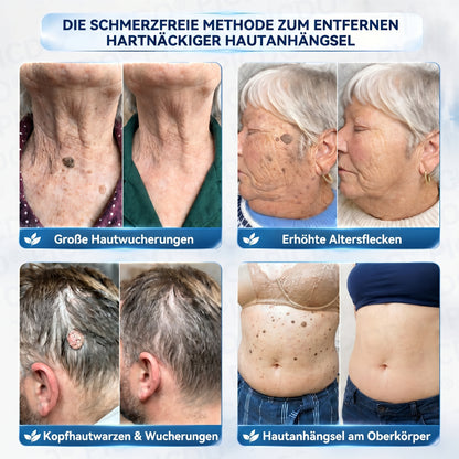 𝐏𝐢𝐜𝐝𝐨® 𝟕-𝐓𝐚𝐠𝐞 𝐇𝐚𝐮𝐭𝐚𝐧𝐡ä𝐧𝐠𝐞𝐫- & 𝐅𝐥𝐞𝐜𝐤𝐞𝐧-𝐄𝐧𝐭𝐟𝐞𝐫𝐧𝐮𝐧𝐠𝐬𝐜𝐫𝐞𝐦𝐞 (𝐒𝐜𝐡𝐦𝐞𝐫𝐳𝐟𝐫𝐞𝐢 & 𝐍𝐚𝐫𝐛𝐞𝐧𝐟𝐫𝐞𝐢-𝐅𝐨𝐫𝐦𝐞𝐥) 🌹