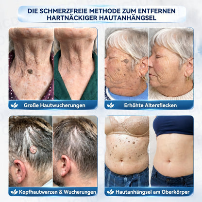 𝑷𝒊𝒄𝒅𝒐® 𝟕-𝐓𝐚𝐠𝐞 𝐇𝐚𝐮𝐭𝐚𝐧𝐡ä𝐧𝐠𝐬𝐞𝐥- & 𝐅𝐥𝐞𝐜𝐤𝐞𝐧-𝐄𝐧𝐭𝐟𝐞𝐫𝐧𝐮𝐧𝐠𝐬𝐜𝐫𝐞𝐦𝐞 🧴(𝐒𝐜𝐡𝐦𝐞𝐫𝐳𝐟𝐫𝐞𝐢𝐞 𝐅𝐨𝐫𝐦𝐞𝐥 – 𝐨𝐡𝐧𝐞 𝐍𝐚𝐫𝐛𝐞𝐧) 💪