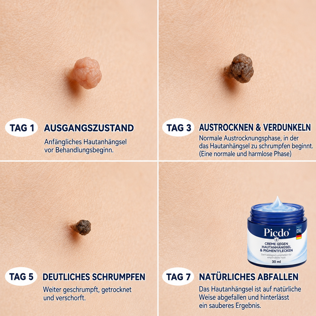 𝐏𝐢𝐜𝐝𝐨® 𝟕-𝐓𝐚𝐠𝐞 𝐈𝐧𝐭𝐞𝐧𝐬𝐢𝐯𝐩𝐟𝐥𝐞𝐠𝐞 𝐟𝐮̈𝐫 𝐇𝐚𝐮𝐭𝐚𝐧𝐡𝐚̈𝐧𝐠𝐬𝐞𝐥 & 𝐇𝐚𝐮𝐭𝐟𝐥𝐞𝐜𝐤𝐞𝐧🌿