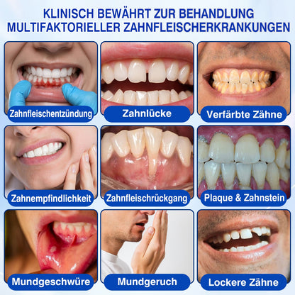 🇩🇪🏅🦷🛡️𝐋𝐮𝐱𝐚𝐫𝐢𝐬𝐞® GumRevive Parodontal-Reparaturgel