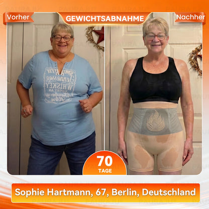 𝗣𝗔𝗨𝗥𝗔𝑱𝑼® 𝗠𝗼𝗿𝗶𝗻𝗴𝒂 & 𝗕𝗲𝗿𝗯𝗲𝗿𝗶𝒏 𝟰-𝗶𝗻-𝟭 𝗠𝗶𝗸𝗿𝗼𝗽𝗮𝗿𝘁𝗶𝗸𝗲𝗹 𝗦𝗵𝗮𝗽𝗶𝗻𝗴- & 𝗙𝗲𝘁𝘁𝘃𝗲𝗿𝗯𝗿𝗲𝗻𝗻𝘂𝗻𝗴𝘀-𝗦𝗵𝗼𝗿𝘁𝘀 ⚡ 𝗦𝘁𝗿𝗮𝗳𝗳𝗲𝗻 & 𝗙𝗼𝗿𝗺𝗲𝗻 𝗶𝗻 𝗻𝘂𝗿 𝟯𝟬 𝗠𝗶𝗻𝘂𝘁𝗲𝗻 ✨ 𝗡𝗲𝘂𝗲𝘀𝘁𝗲𝘀 𝗠𝗼𝗱𝗲𝗹𝗹 𝟮𝟬𝟮𝟲 💪
