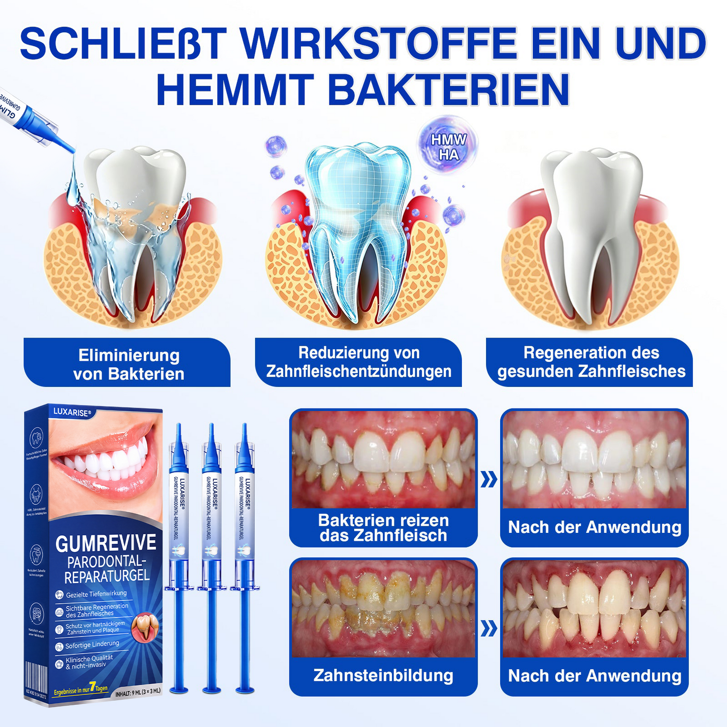 🇩🇪🏅🦷🛡️𝐋𝐮𝐱𝐚𝐫𝐢𝐬𝐞® GumRevive Parodontal-Reparaturgel