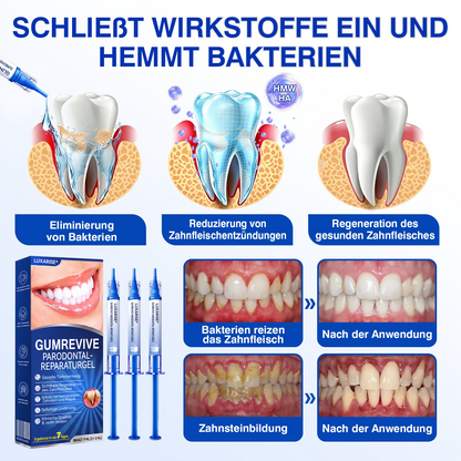 🇩🇪🏅🦷🛡️𝐋𝐮𝐱𝐚𝐫𝐢𝐬𝐞® GumRevive Parodontal-Reparaturgel