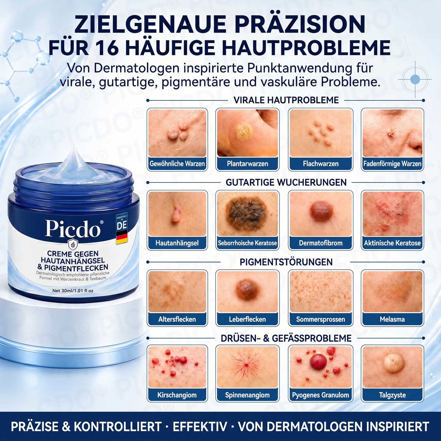 𝐏𝐢𝐜𝐝𝐨® 𝟕-𝐓𝐚𝐠𝐞 𝐇𝐚𝐮𝐭𝐚𝐧𝐡ä𝐧𝐠𝐞𝐫- & 𝐅𝐥𝐞𝐜𝐤𝐞𝐧-𝐄𝐧𝐭𝐟𝐞𝐫𝐧𝐮𝐧𝐠𝐬𝐜𝐫𝐞𝐦𝐞 (𝐒𝐜𝐡𝐦𝐞𝐫𝐳𝐟𝐫𝐞𝐢 & 𝐍𝐚𝐫𝐛𝐞𝐧𝐟𝐫𝐞𝐢-𝐅𝐨𝐫𝐦𝐞𝐥) 🌹